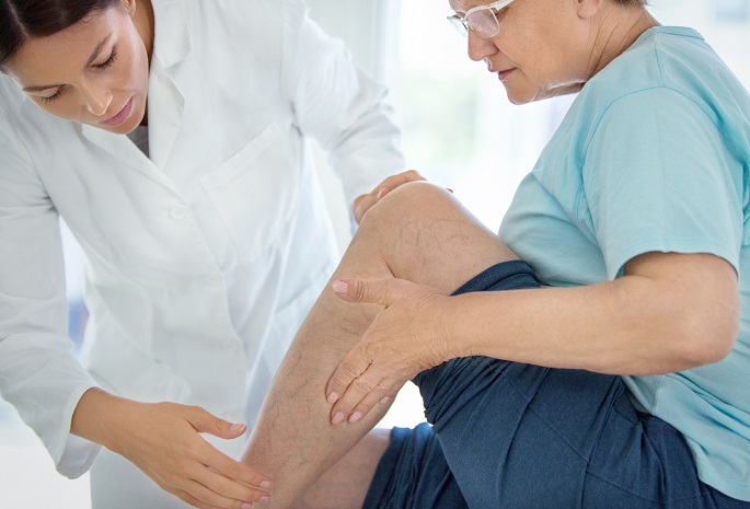 female doctor treats legs of senior woman with varicose veins